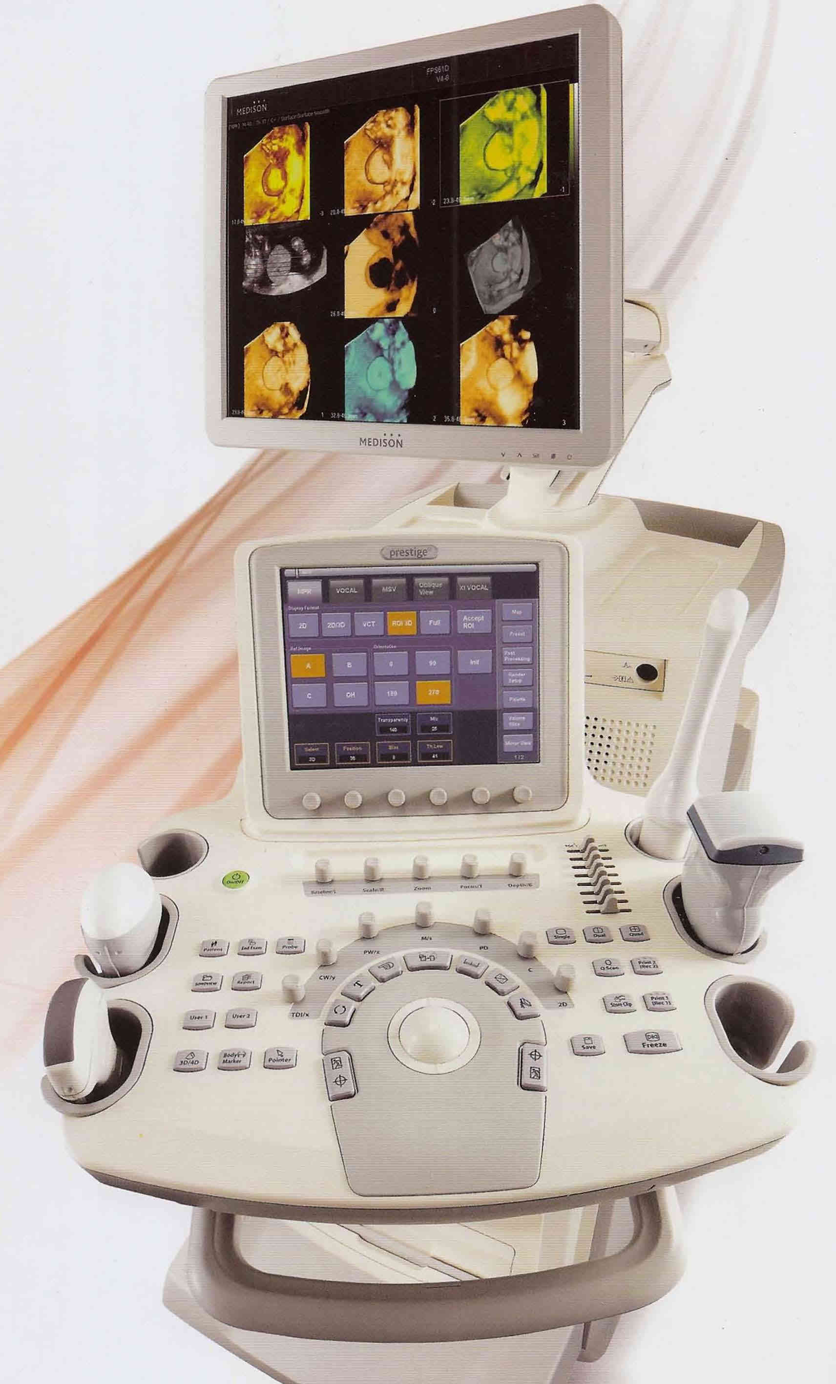 medison samsung accuvix V20 tridimensionale